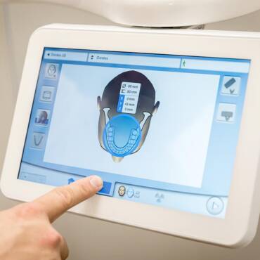 diseño sonrisa mallorca