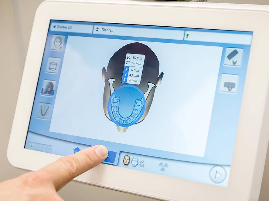 diseño sonrisa mallorca