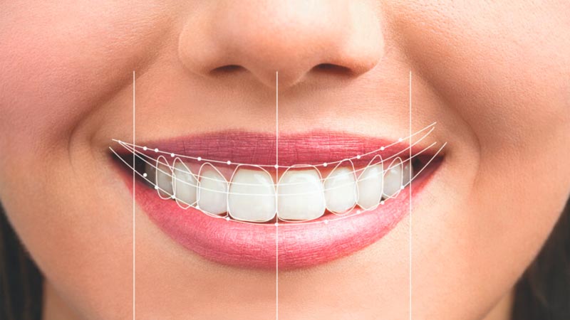 diseño sonrisa mallorca